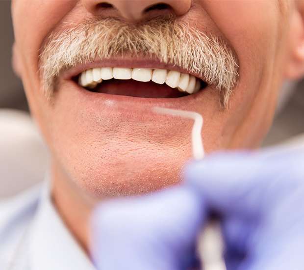Encinitas Adjusting to New Dentures