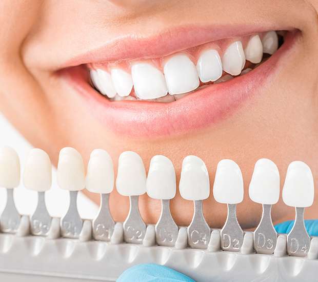 Encinitas Cosmetic Dentist