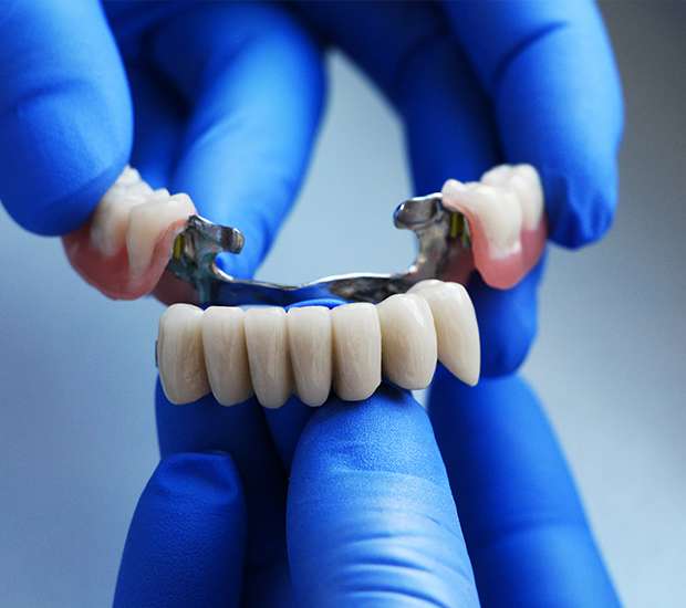 Encinitas Dental Bridges