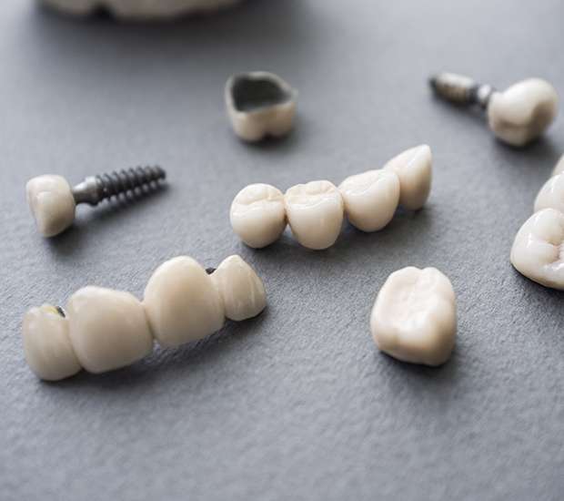 Encinitas The Difference Between Dental Implants and Mini Dental Implants
