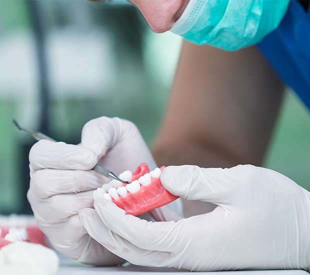 Encinitas Partial Denture for One Missing Tooth
